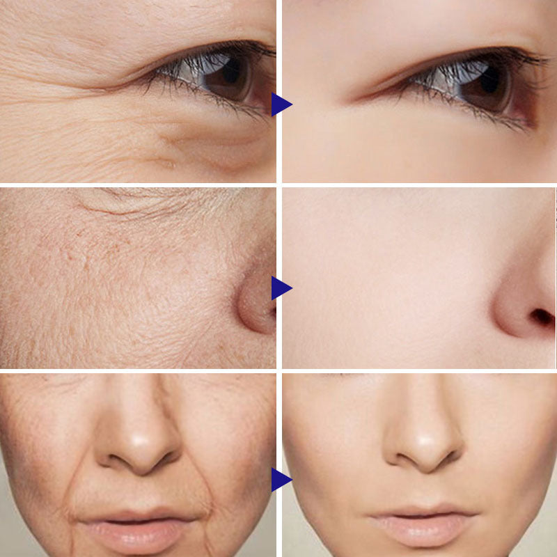 Before and after images showing the effects of using Vitamin C Serum on wrinkles and skin texture improvement.