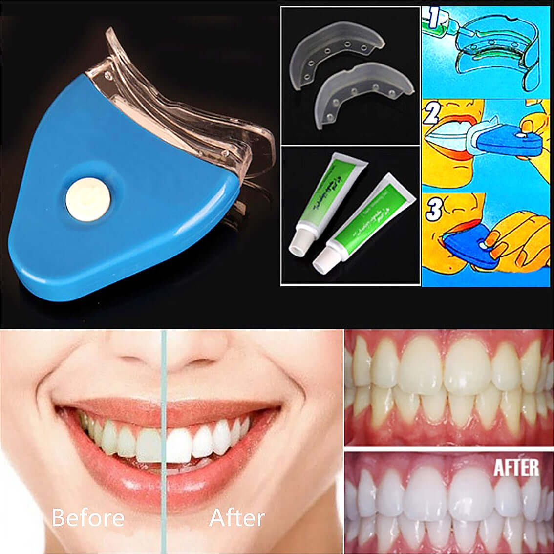 "Oral Gel Teeth Whitening - Dental Bleaching Gel with LED Light for Effective Tooth Whitening"