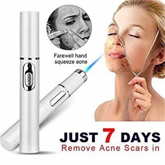 "Blue Light Therapy Acne Laser Pen - Soft Scar and Wrinkle Removal Treatment Device for Skin Care and Beauty"