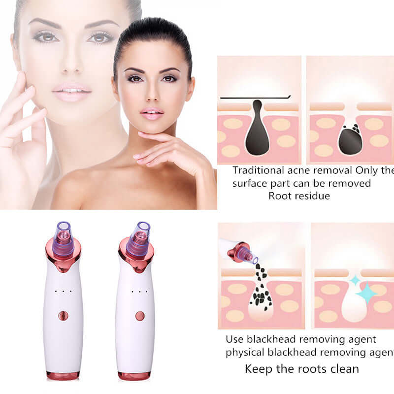 "Blackhead Remover Tool - Acne Vacuum Suction for Pore Cleaning and Black Dot Removal, Face Cleanser for Beauty Skin Care"