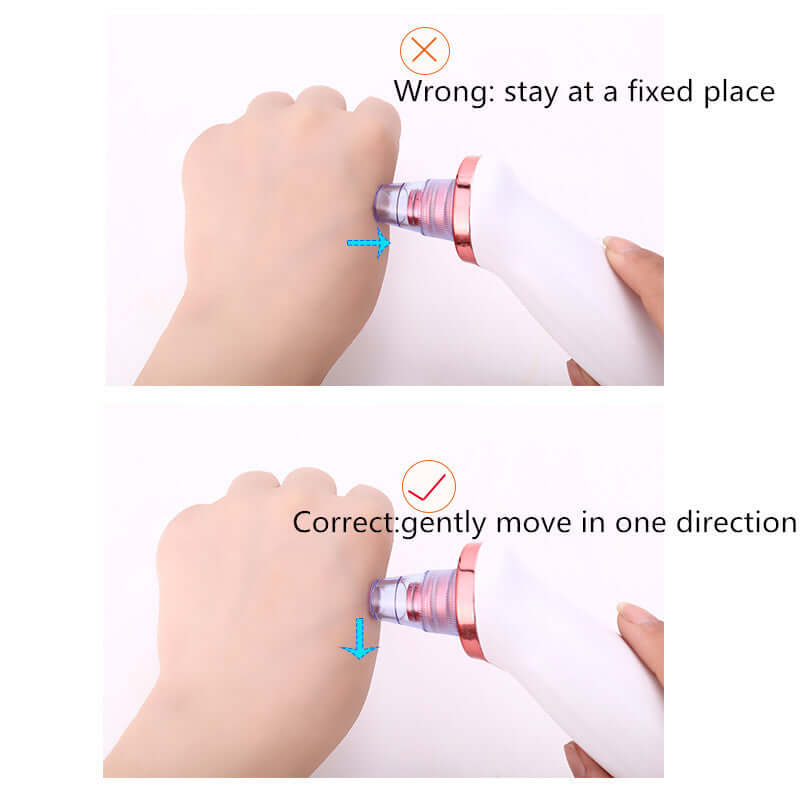 "Blackhead Remover Tool - Acne Vacuum Suction for Pore Cleaning and Black Dot Removal, Face Cleanser for Beauty Skin Care"