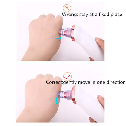 "Blackhead Remover Tool - Acne Vacuum Suction for Pore Cleaning and Black Dot Removal, Face Cleanser for Beauty Skin Care"
