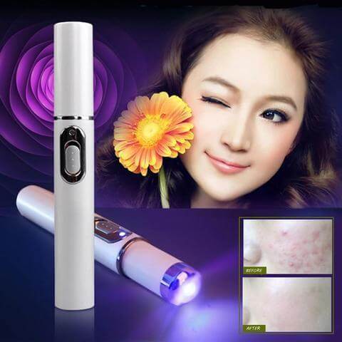 "Blue Light Therapy Acne Laser Pen - Soft Scar and Wrinkle Removal Treatment Device for Skin Care and Beauty"