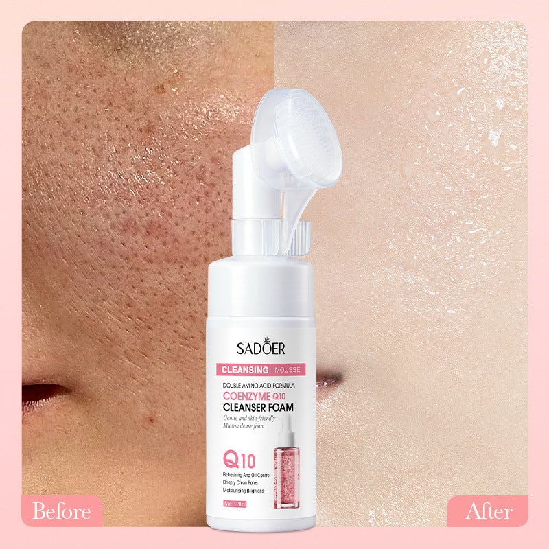 Hyaluronic Acid Amino Acid Cleansing Mousse with before and after skin improvement results shown, facial cleanser bottle in center.