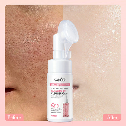 Hyaluronic Acid Amino Acid Cleansing Mousse with before and after skin improvement results shown, facial cleanser bottle in center.