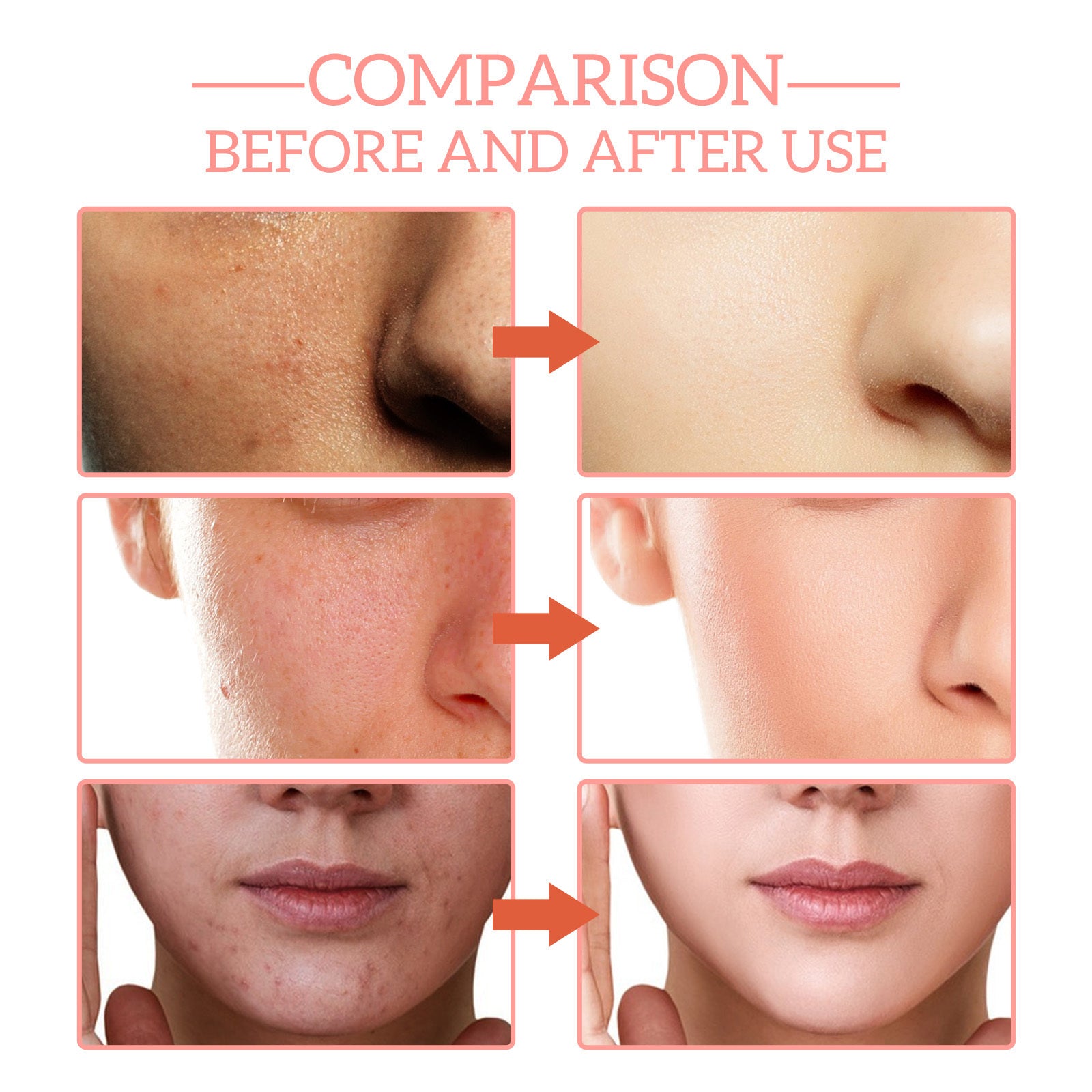 "Before and after comparison of skin improvement using facial serum, showing reduced pores and smoother texture."