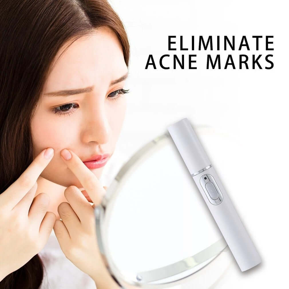 "Blue Light Therapy Acne Laser Pen - Soft Scar and Wrinkle Removal Treatment Device for Skin Care and Beauty"