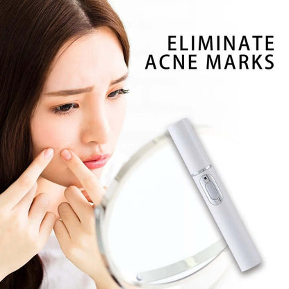 "Blue Light Therapy Acne Laser Pen - Soft Scar and Wrinkle Removal Treatment Device for Skin Care and Beauty"