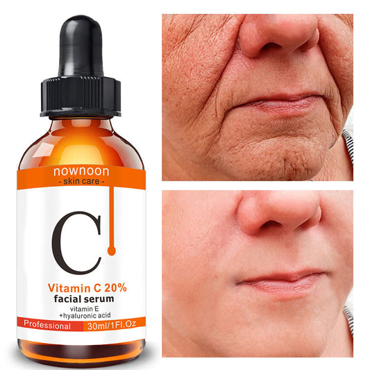 Vitamin C Facial Serum 30ml for hydration with snow lotus, showing before and after skin improvement.